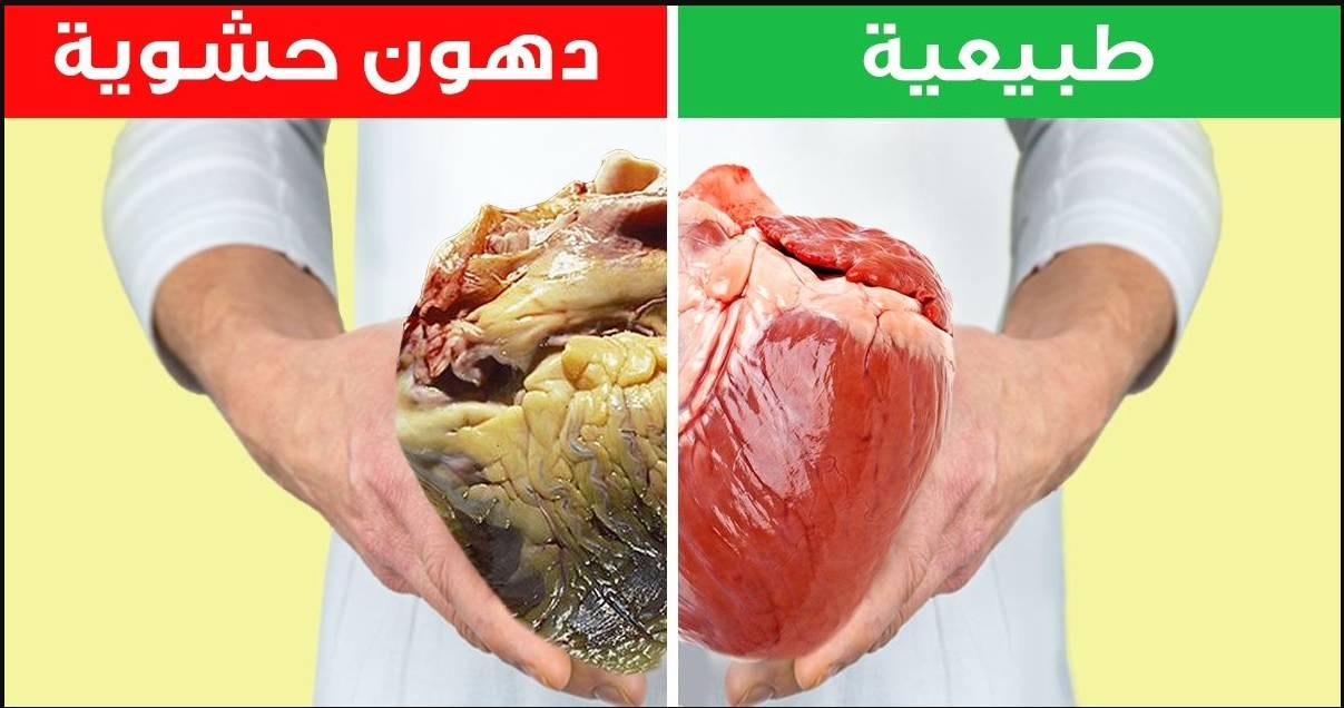 جل التستوستيرون يخفض الدهون الحشوية للمسنات