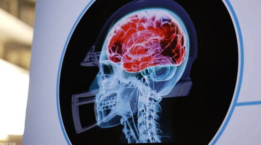 مؤشر بيولوجي لتشخيص الزهايمر قبل ظهور أعراضه