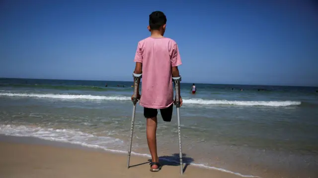 القيود الإسرائيلية تزيد معاناة مبتوري الأطراف في غزة